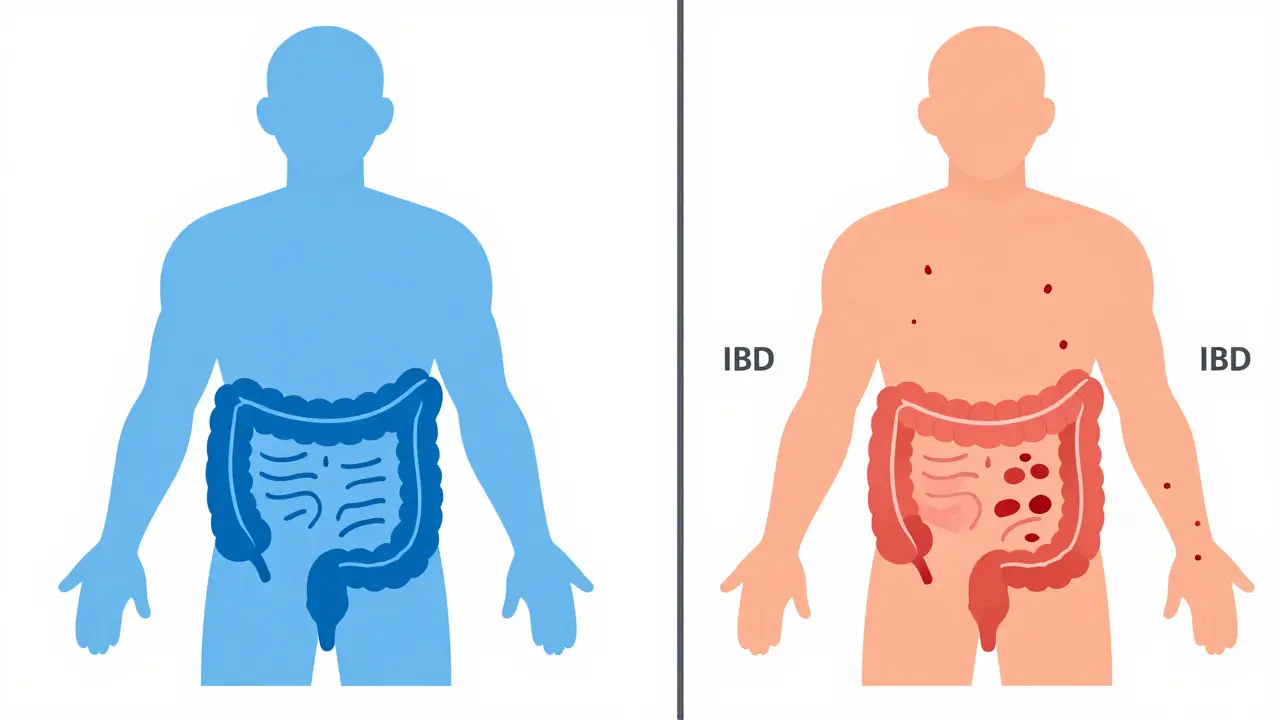 IBS vs. IBD: Understanding the Difference Between Functional and Inflammatory Bowel Disorders