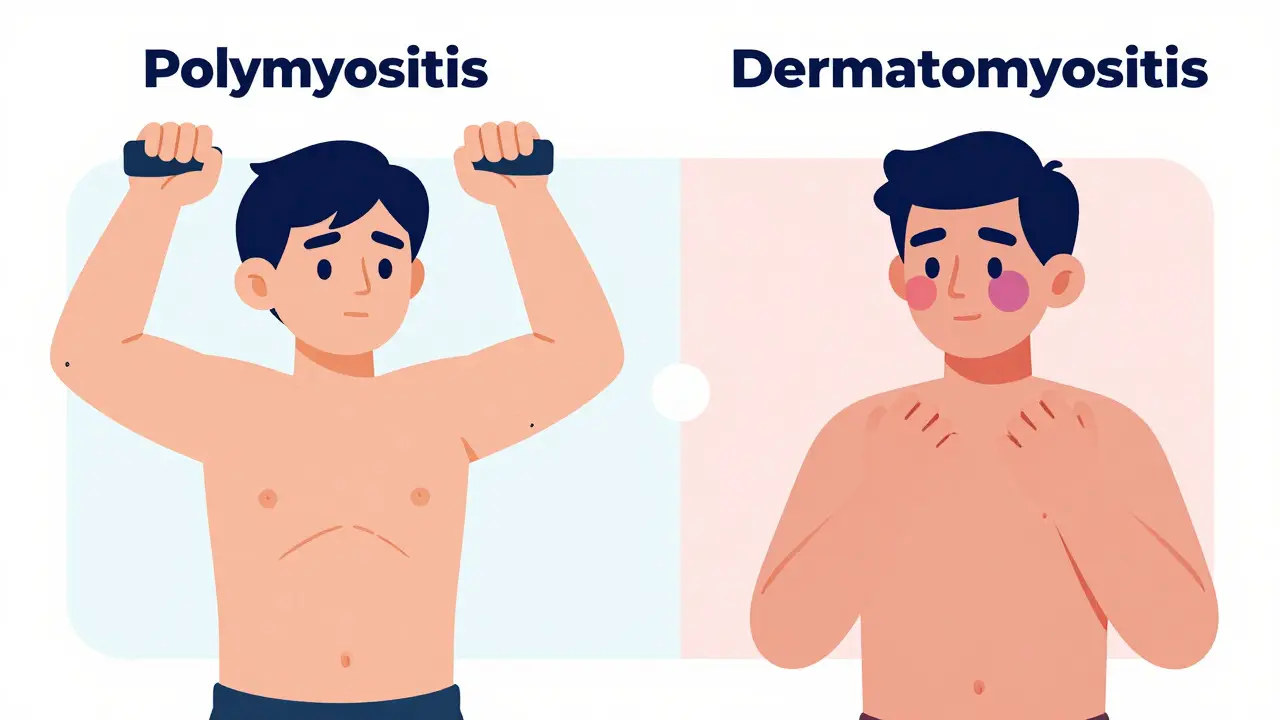 Dermatomyositis and Polymyositis: Symptoms, Diagnosis, and Modern Treatment Options
